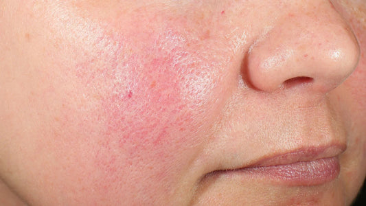 The Skin Barrier Repair Guide: 7 Expert Ways to Restore Healthy Skin