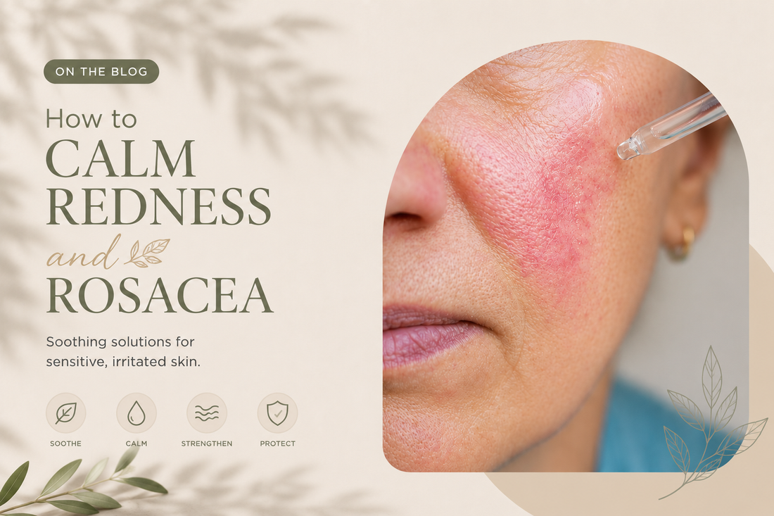 How to Calm Redness and Rosacea